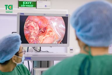 Xem mổ ruột thừa bên nào, nên mổ nội soi hay mổ mở?