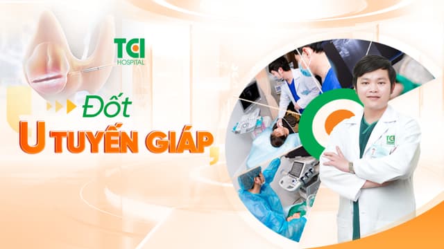 Đốt u tuyến giáp công nghệ sóng cao tần RFA