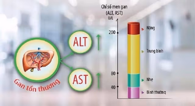 Chỉ số men gan cao bao nhiêu là nguy hiểm?