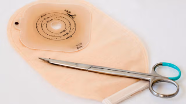 Bao lâu thay túi hậu môn nhân tạo 1 lần? Hướng dẫn thay