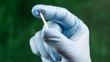 Bị cường giáp có cấy que tránh thai được không?