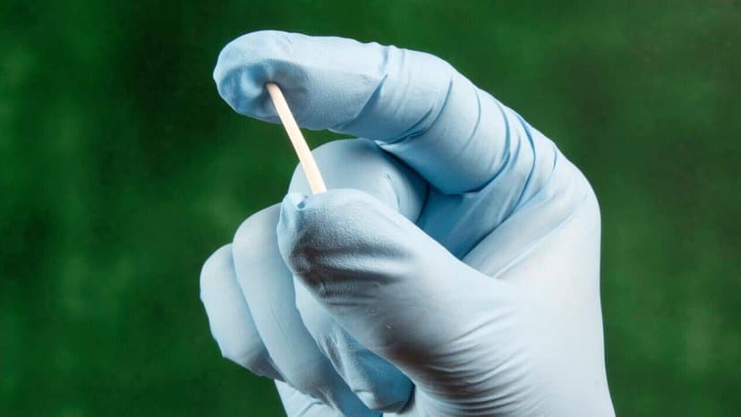 Bị cường giáp có cấy que tránh thai được không?