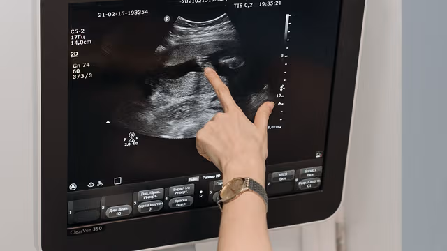 Các chỉ số trong siêu âm doppler tim và cách đọc kết quả