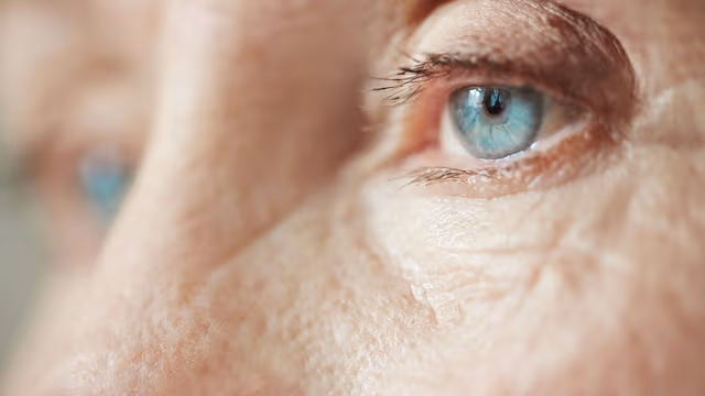 Dấu hiệu mắt bị đục thủy tinh thể giai đoạn đầu