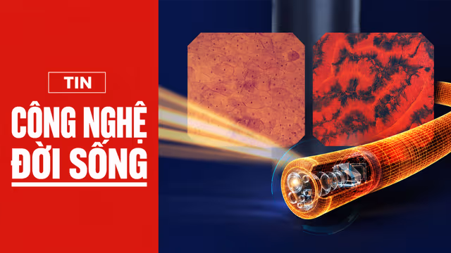 Siêu nội soi Endocyto 520x đánh dấu bước ngoặt trong nội soi tiêu hóa