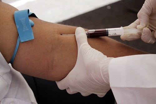 Trong xét nghiệm máu, một mẫu máu nhỏ được lấy từ cơ thể của người cần xét nghiệm, thường là ở tĩnh mạch cánh tay.