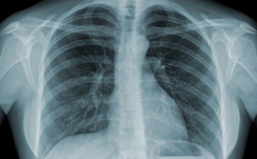 Chụp X-quang được sử dụng nhiều trong y học giúp chẩn đoán các bệnh bên trong cơ thể về tim mạch, xương khớp...