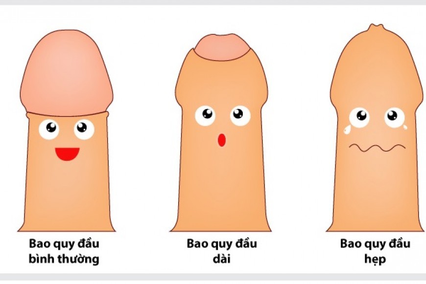 nhung-benh-ly-lien-quan-den-bao-quy-dau-cua-nam-gioi