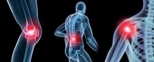Không có bằng chứng nào cho biết sự thay đổi thời tiết gây ra những tổn hại chung về khớp