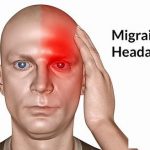 Những điều cần biết về bệnh đau nửa đầu