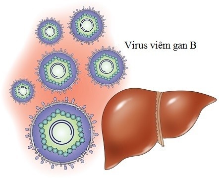Chữa bệnh viêm gan siêu vi b có mất nhiều thời gian không