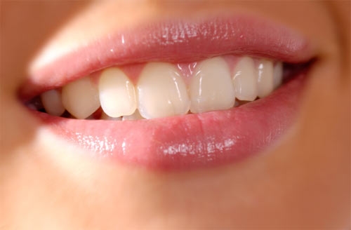 Một hàm răng đều đẹp, trắng bóng là mơ ước của bất cứ ai