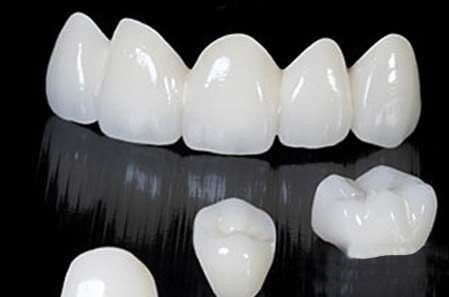 Để vừa đảm bảo chức năng nhai, vừa đảm bảo sức khỏe chung cho cả hàm răng và đảm bảo tính thẩm mỹ, làm răng giả nhựa là biện pháp giúp bù đắp khi bị mất răng.