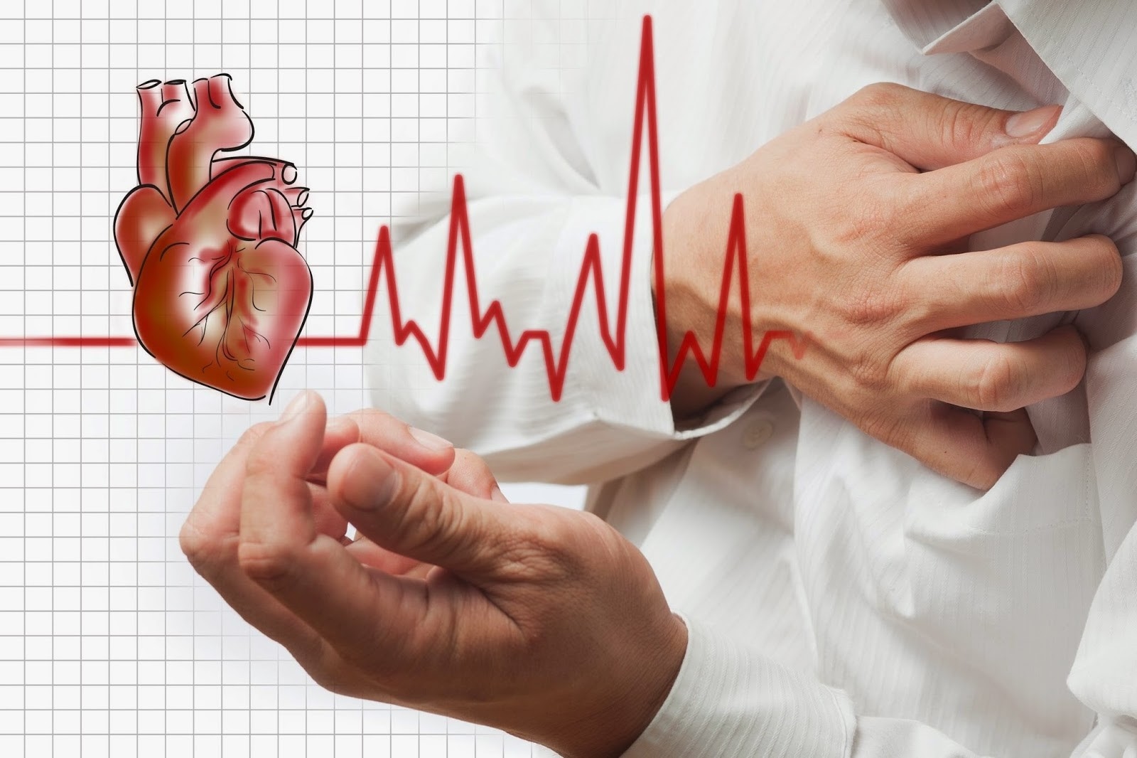 Bệnh ép tim là gì? Nguyên nhân, dấu hiệu nhận biết và điều trị ra sao?