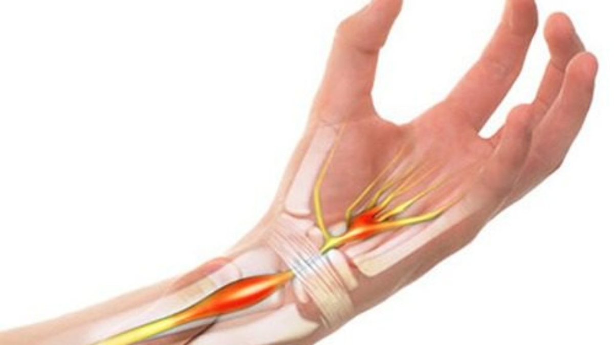 Nguyên nhân gây viêm khớp cổ tay sau sinh