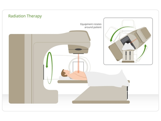 Các phương pháp điều trị ung thư phổi