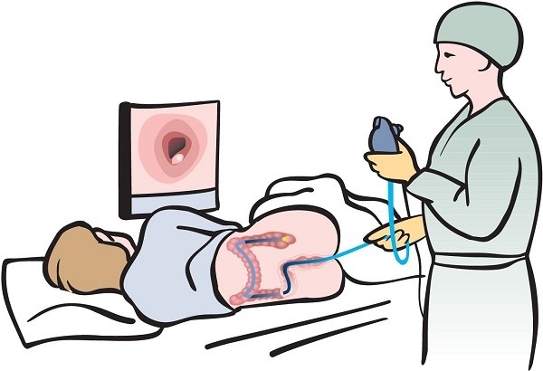 Cách phòng bệnh ung thư đại trực tràng hiệu quả