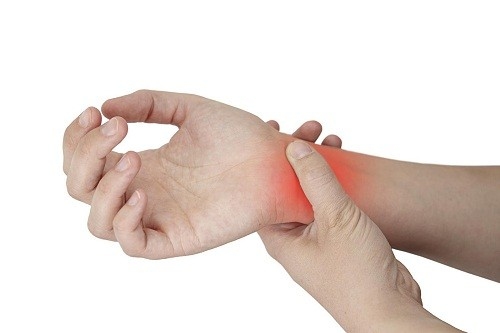 Hội chứng ống cổ tay cũng là nguyên nhân gây đau cổ tay và bàn tay.