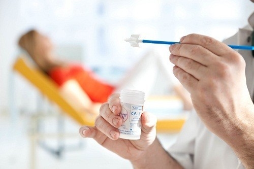 Xét nghiệm Pap và những điều cần biết
