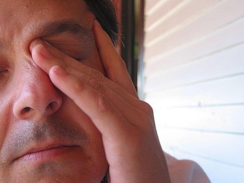 Khô mắt có thể gây khó chịu, gây ngứa hoặc rát ở mắt. 