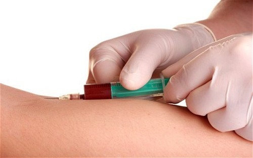 Xét nghiệm estradiol là gì chi phí là bao nhiêu