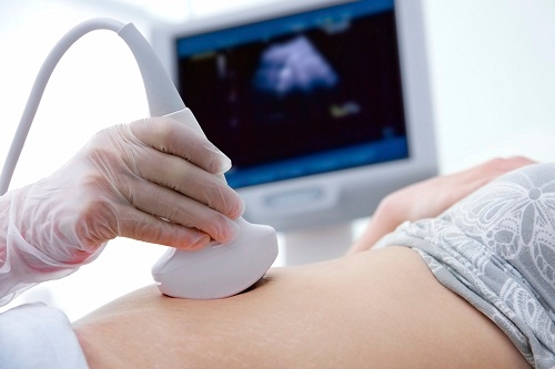 Tràn dịch màng phổi thường được chẩn đoán qua siêu âm định kỳ thai nhi