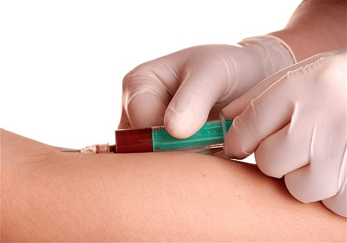 Xét nghiệm hCG giúp chẩn đoán thai nhanh