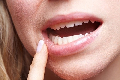 Bệnh tiểu đường có thể làm suy yếu khả năng của cơ thể trước sự tấn công của vi trùng, làm tăng nguy cơ nhiễm trùng ở nướu răng và xương ổ răng