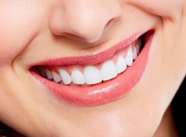 Bọc răng khoa Răng hàm mặt &#8211; bệnh viện Thu Cúc
