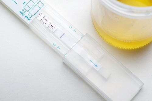 Nước tiểu màu đỏ nghĩa là có máu trong nước tiểu đồng thời là dấu hiệu của một vấn đề nghiêm trọng. 