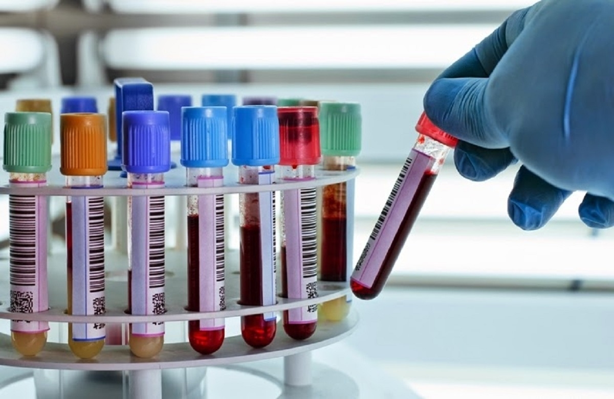 Giải đáp thắc mắc: Xét nghiệm estradiol để làm gì?