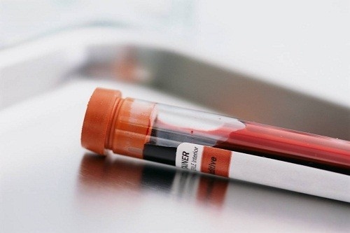 Xét nghiệm máu khi mang thai cho biết hàm lượng heamoglobin có trong máu. 