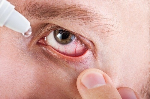 Việc điều trị tùy thuộc vào nguyên nhân dẫn tới tình trạng khô mắt và mờ mắt.