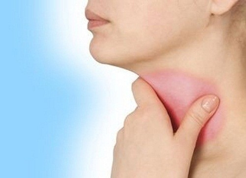 Nếu cơ thể bị nhiễm trùng, các hạch ngoại vi sẽ sưng, viêm và đau.