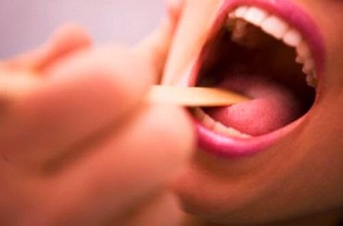 Bệnh viêm amidan có lây không?