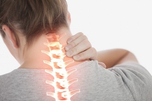 Thoát vị đĩa đệm cũng là một trong những nguyên nhân có thể gây đau cổ 