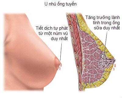 u nhu trong ong sua