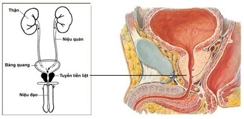 Tuyến tiền liệt rất dễ bị viêm và mắc một số bệnh lý khác nhau như u xơ, vôi hóa, ung thư