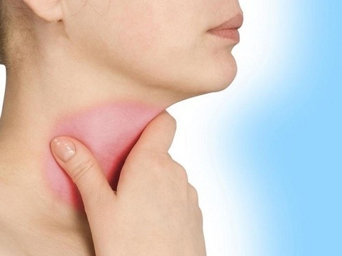 Khi bị viêm thanh quản, người bệnh sẽ cảm thấy đau họng, có cảm giác nóng, khô họng, ho khan, có cảm giác ngứa, rát