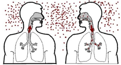 Bệnh lao lây truyền qua đường hô hấp khi người bệnh ho, hắt hơi...