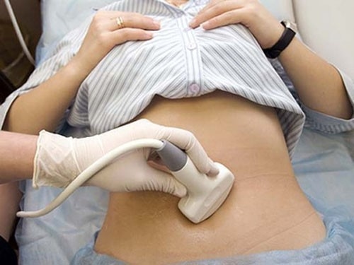 U bì buồng trứng thường chỉ được phát hiện qua siêu âm hoặc khám sức khỏe định kỳ