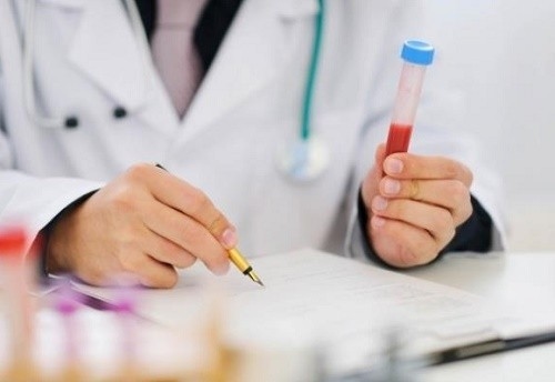 Xét nghiệm AST và ALT là gì? cần lưu ý điều gì
