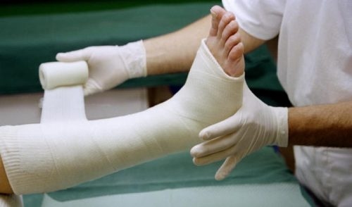 những bước sơ cứu khi gãy xương