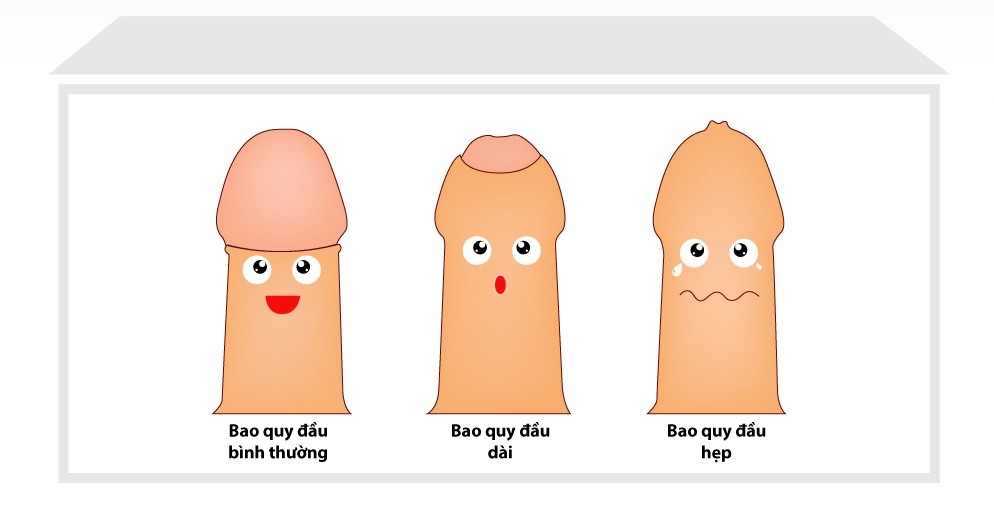 Cắt bao quy đầu bao nhiêu tiền?
