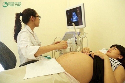Siêu âm 4D tại bệnh viện Thu Cúc hiệu quả chính xác
