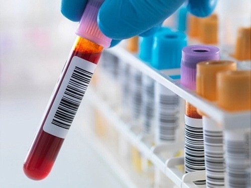 HIV là bệnh lý nguy hiểm cần được phát hiện sớm và điều trị hiệu quả