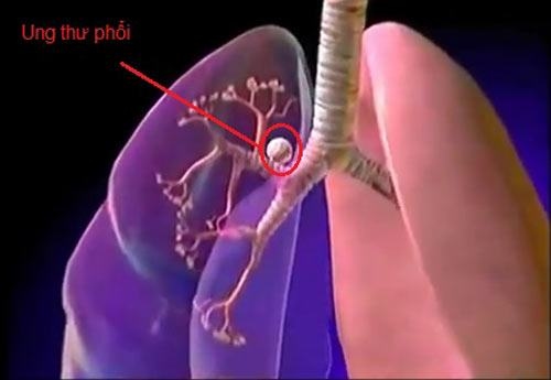 sự thật thú vị về phổi và các bệnh lý liên quan