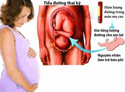 Mẹ bầu bị tiểu đường ảnh hưởng đến thai nhi