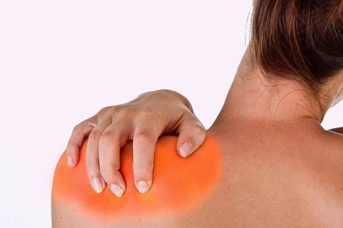 Viêm co rút bao khớp vai cũng gây đau vai gáy