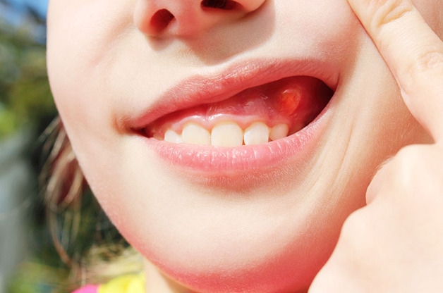sưng phù mặt là do đâu